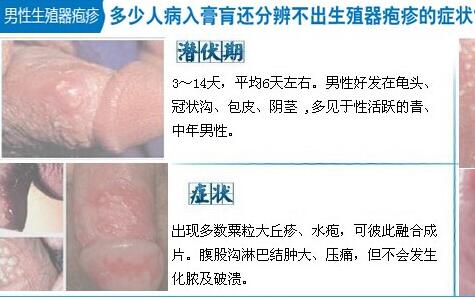 男性泌尿感染初期的图片到底是什么样的